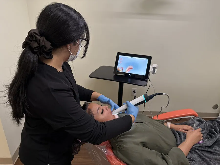 Digital iTero intraoral scan in progress at Deccan Dental, San Mateo